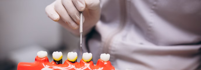 Missing Tooth Replacement - Dental Bridge