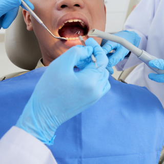 Hybrid Dentures Care and Maintenance