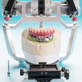 Hybrid Dentures - Stability